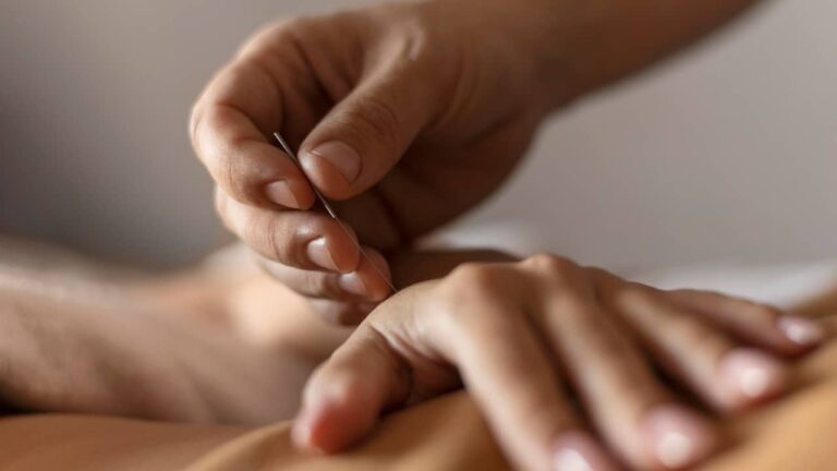 Acupuncture : derrière les aiguilles, quels sont les bienfaits réels ? accupuncture mains