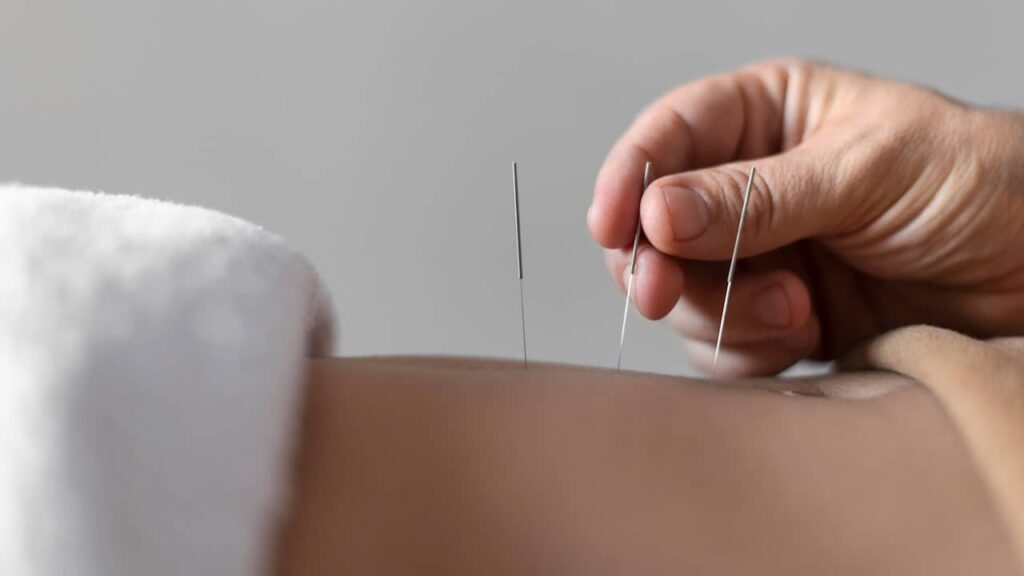 accupuncture ventre